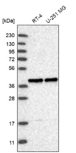 CYP24A1 Antibody, Novus Biologicals:Antibodies:Primary Antibodies